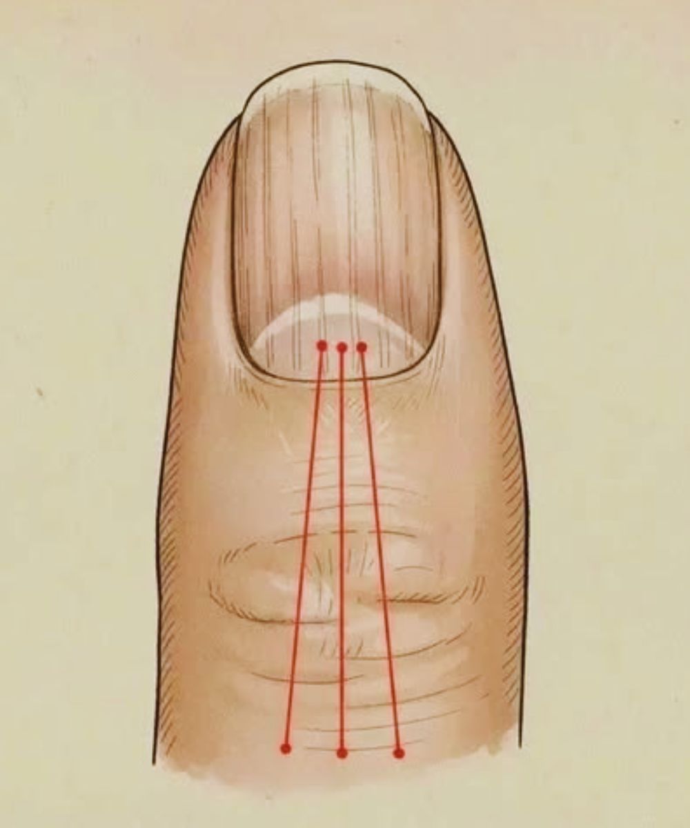 What to Eat to Reduce Nail Ridges: A Nutrition Guide for Healthier Nails