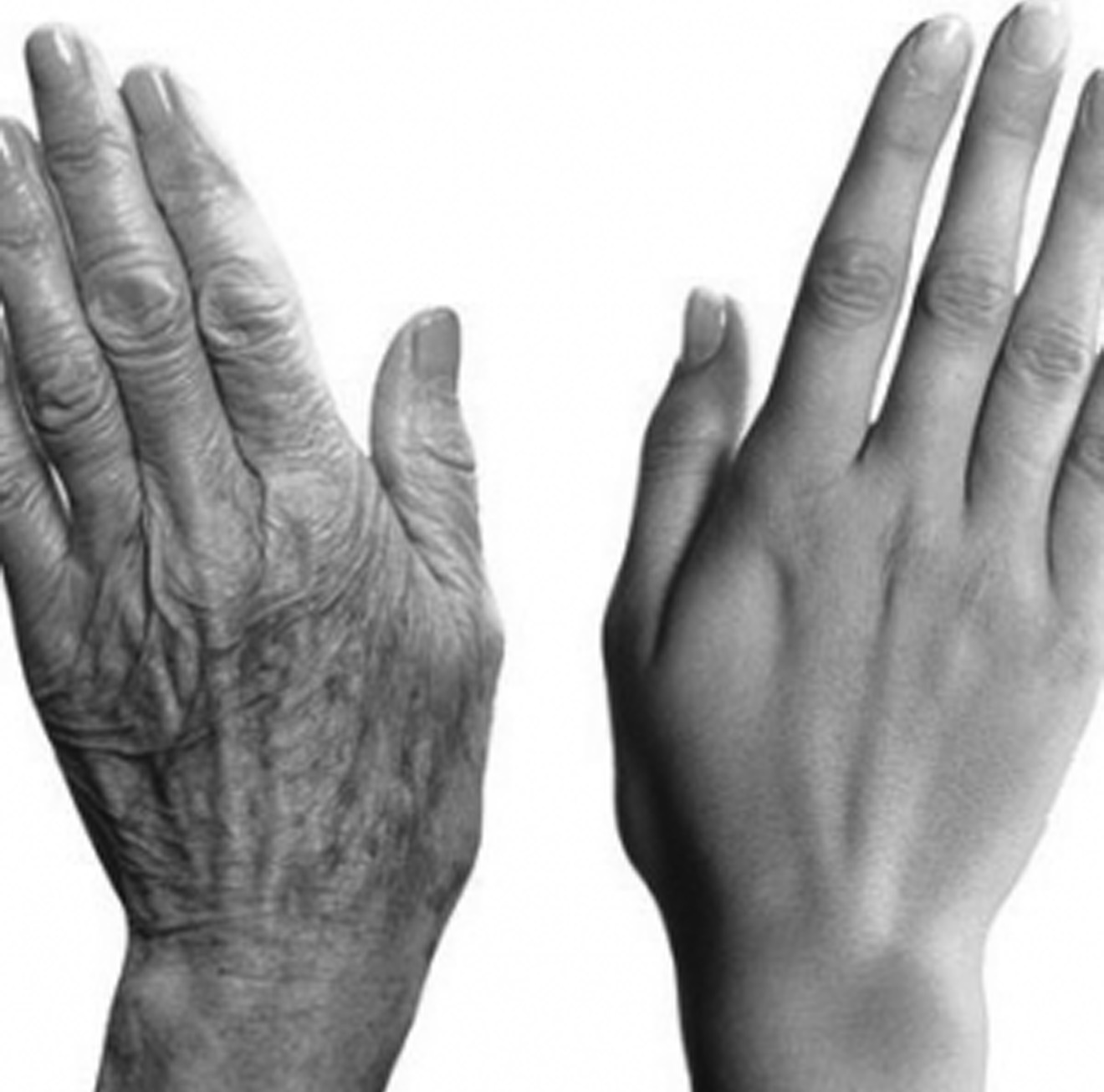 Liście laurowe są o wiele skuteczniejsze niż botoks i kolagen! Niwelują wszystkie zmarszczki i linie mimiczne. Musisz coś powiedzieć, żebym mogła dalej otrzymywać moje przepisy